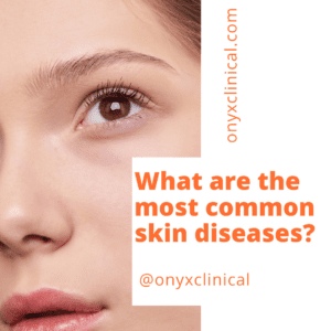 What are the most common skin diseases?